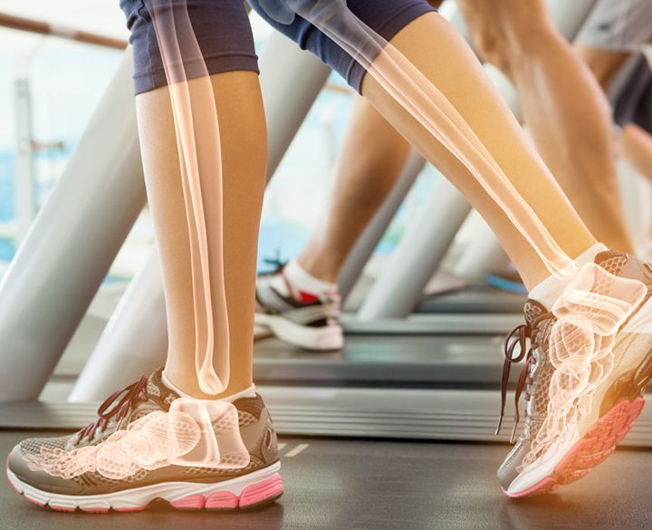 When to Opt for Bone Density Test?