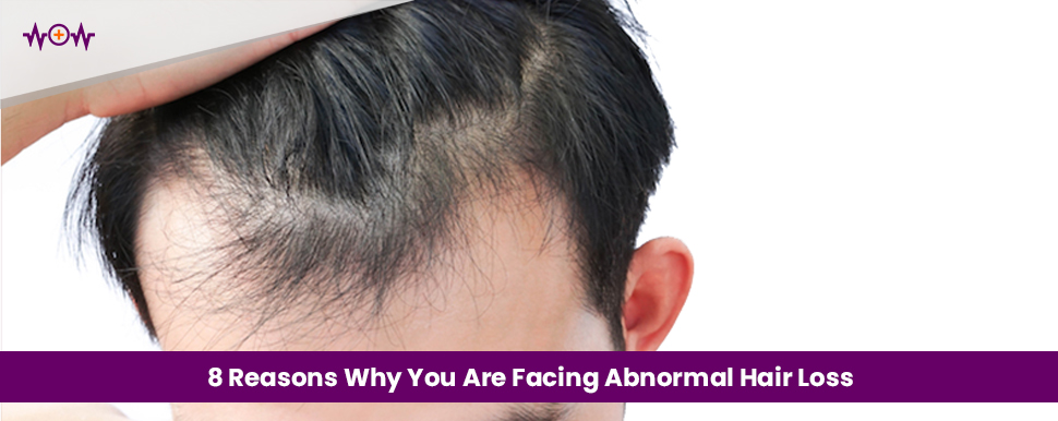8 Reasons Why You Are Facing Abnormal Hair Loss
