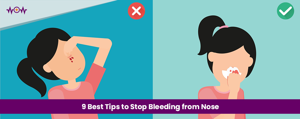 9 Best Tips to Stop Bleeding from Nose