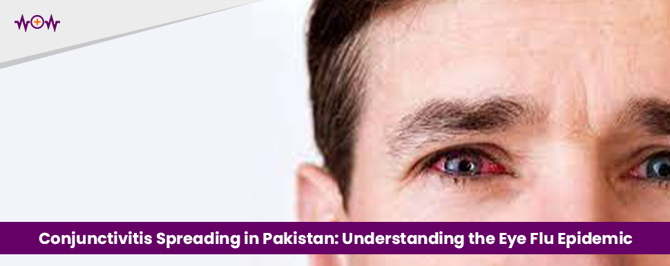 Conjunctivitis Spreading in Pakistan: Understanding the Eye Flu Epidemic